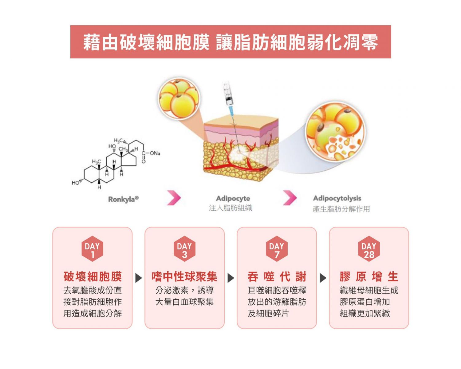 藉由破壞細胞膜 讓脂肪細胞弱化凋零 Day1 > 破壞細胞膜 去氧膽酸成份直接對脂肪細胞作用造成細胞分解 Day3 > 嗜中性球聚集 分泌激素,誘導大量白血球聚集 Day7 > 吞噬代謝 巨噬細胞吞噬釋放出的游離脂肪及細胞碎片 Day28 > 膠原增生 纖維母細胞生成膠原蛋白增加組織更加緊緻