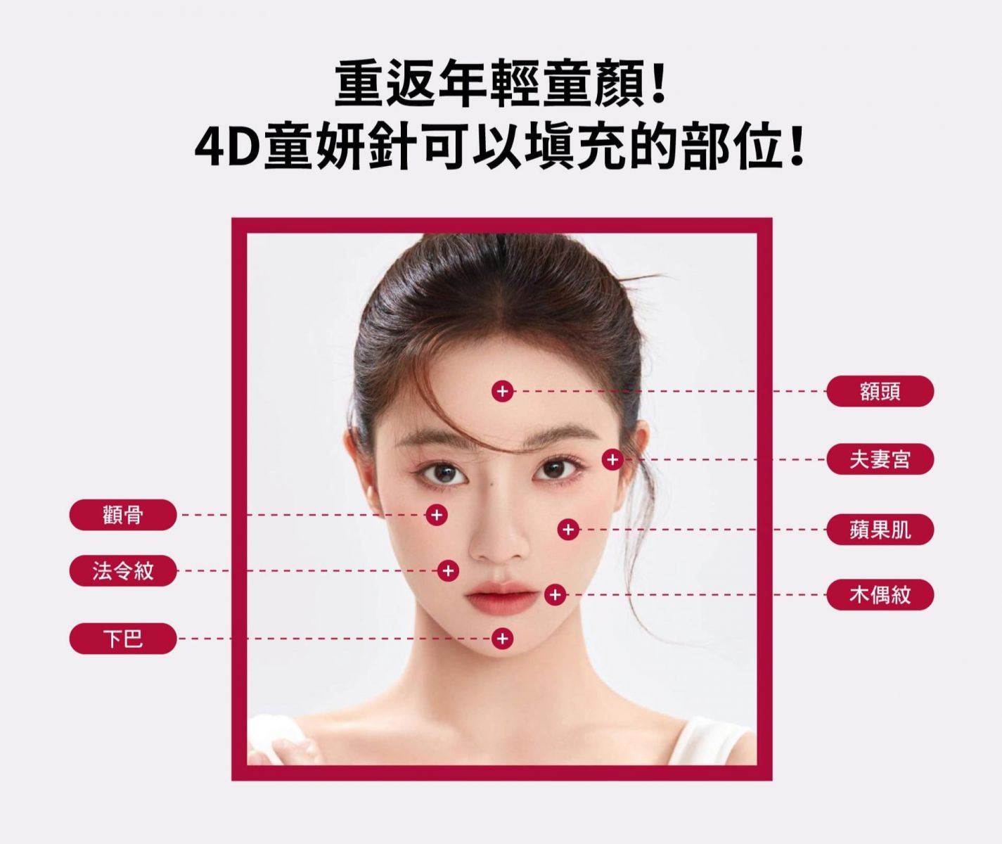  重返年輕童顏!  4D童妍針可以填充的部位!  顴骨、法令紋、下巴、額頭、夫妻宮、蘋果肌、木偶紋