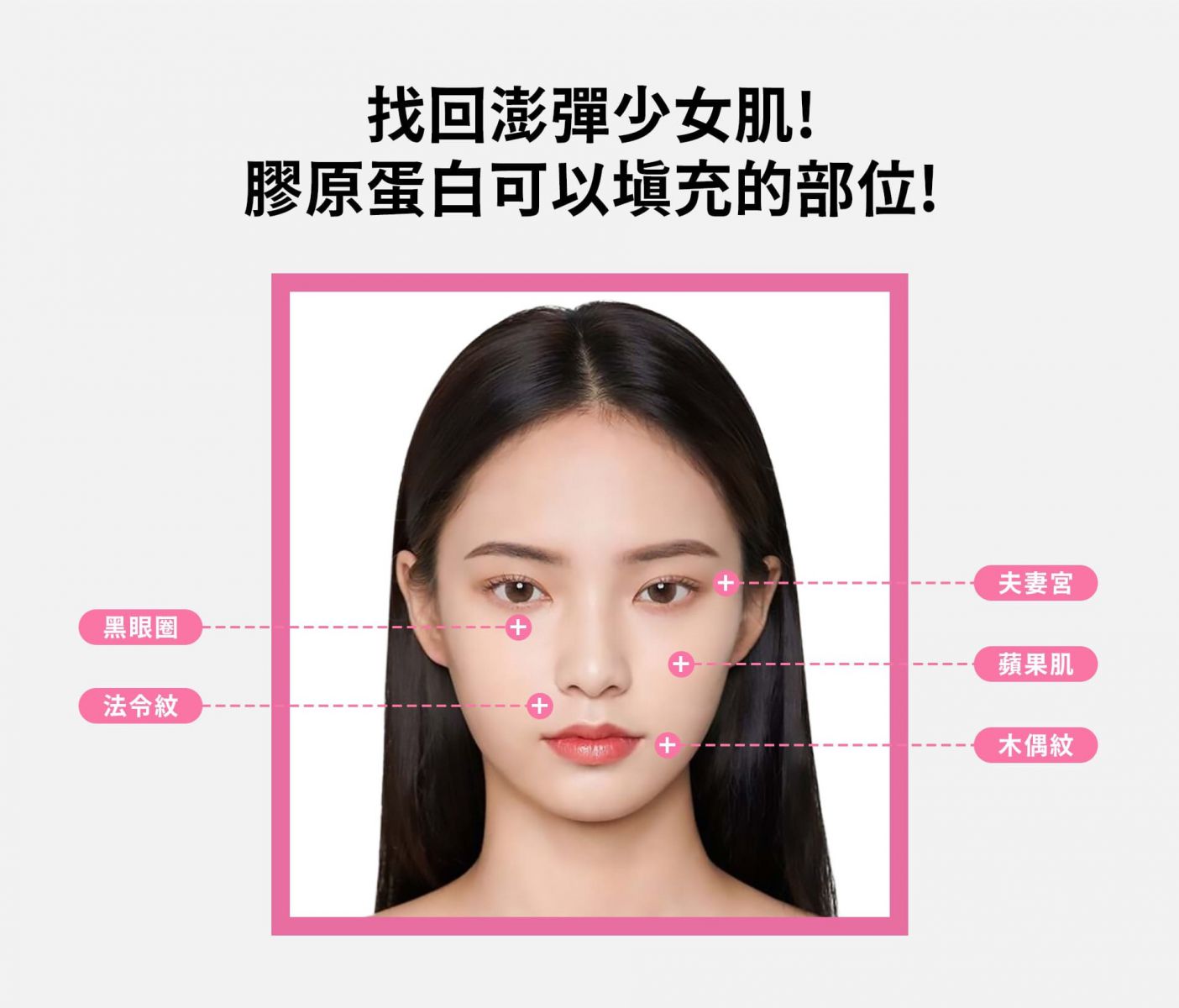 找回澎彈少女肌!膠原蛋白可以填充的部位! 夫妻宮、黑眼圈、法令紋、蘋果肌、木偶紋