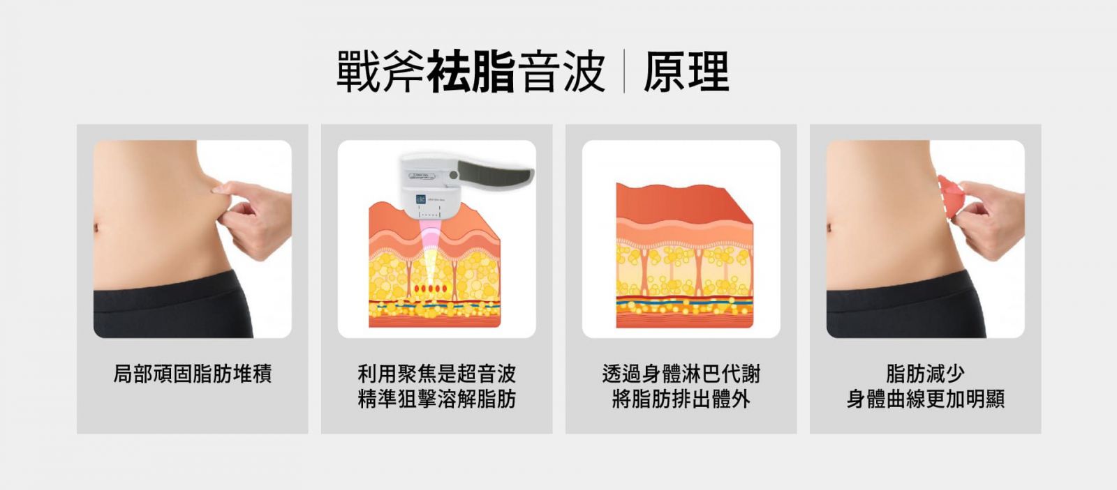 戰斧音波原理 1. 局部頑固脂肪堆積? 2. 利用聚焦是超音波,精準狙擊溶解脂肪 3. 透過身體淋巴代謝,將脂肪排出體外 3. 脂肪減少,身體曲線更加明顯